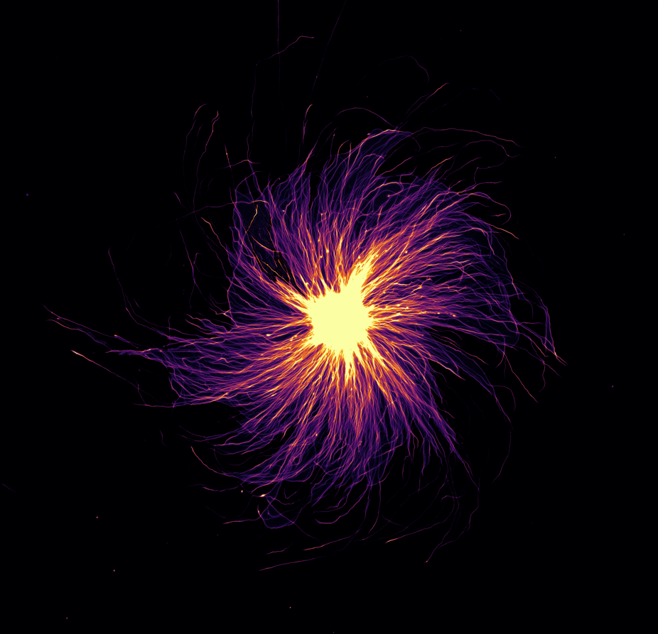 Axons of human iPSC derived motorneurons growing out of a neurosphere